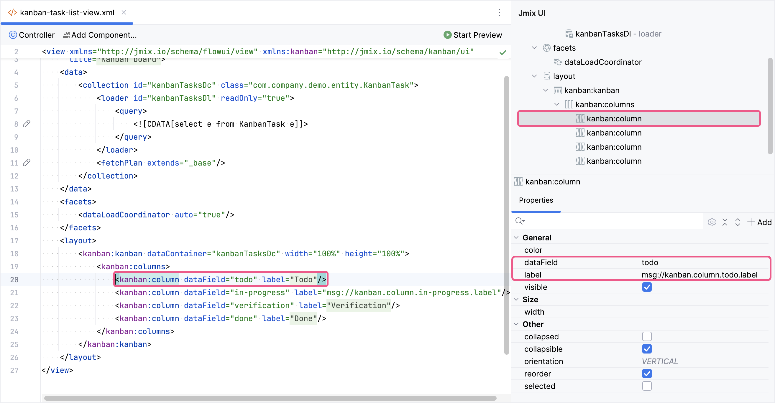 configure kanban columns